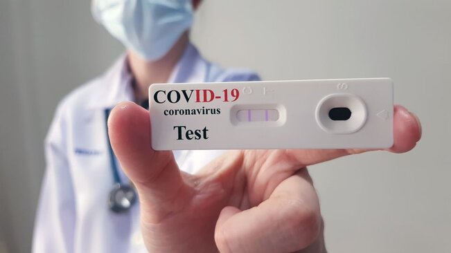 Testagem rápida em massa contra Covid-19 na Comunidade do Potinga